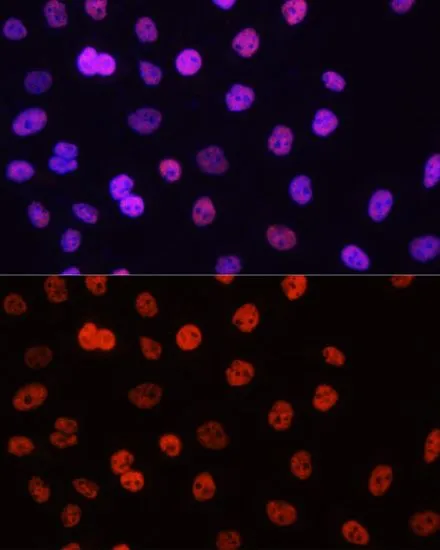 ICC/IF analysis of HeLa cells using GTX55484 Histone H3R17me2 (di-methyl Arg17) antibody. Blue : DAPI Dilution : 1:100