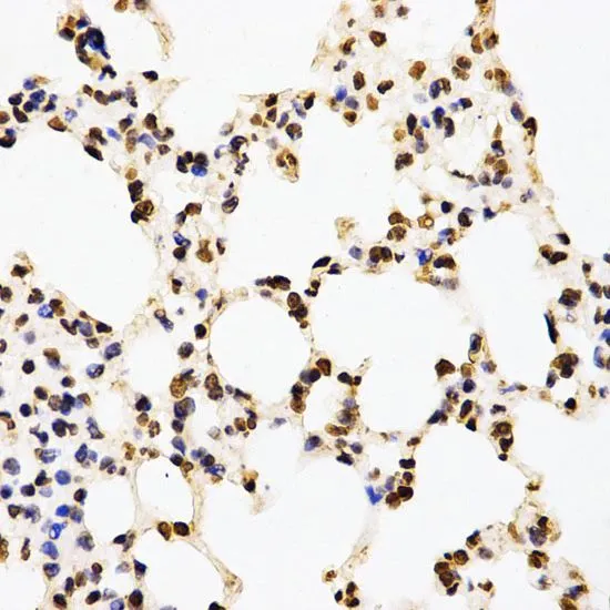 IHC-P analysis of mouse lung tissue using GTX55484 Histone H3R17me2 (di-methyl Arg17) antibody. Dilution : 1:200
