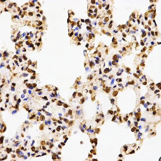 IHC-P analysis of rat lung tissue using GTX55484 Histone H3R17me2 (di-methyl Arg17) antibody. Dilution : 1:200