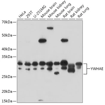 WB analysis of various sample lysates using GTX55485 14-3-3 epsilon antibody. <br>Dilution : 1:3000<br>Loading : 25&#956;g per lane