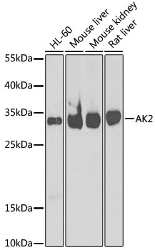 WB analysis of various sample lysates using GTX55493 Adenylate kinase 2 antibody. Dilution : 1:1000 Loading : 25microg per lane