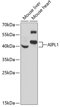 WB analysis of various sample lysates using GTX55497 AIPL1 antibody. Dilution : 1:1000 Loading : 25microg per lane WB analysis of various sample lysates using GTX55497 AIPL1 antibody. Dilution : 1:1000 Loading : 25microg per lane