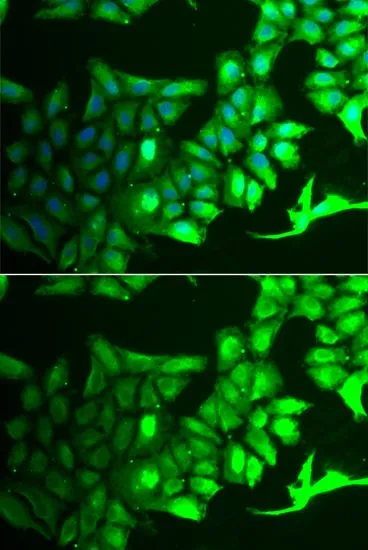 ICC/IF analysis of HeLa cells using GTX55497 AIPL1 antibody. Blue : DAPI