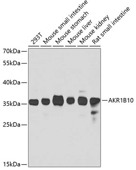 WB analysis of various sample lysates using GTX55498 AKR1B10 antibody. Dilution : 1:1000 Loading : 25microg per lane WB analysis of various sample lysates using GTX55498 AKR1B10 antibody. Dilution : 1:1000 Loading : 25microg per lane