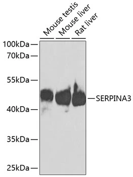 WB analysis of various sample lysates using GTX55503 alpha 1 Antichymotrypsin antibody. Dilution : 1:1000 Loading : 25microg per lane WB analysis of various sample lysates using GTX55503 alpha 1 Antichymotrypsin antibody. Dilution : 1:1000 Loading : 25microg per lane