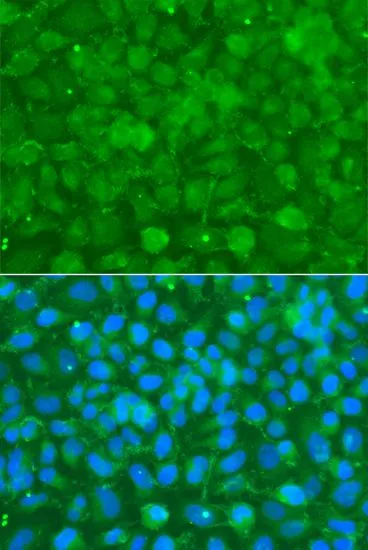 ICC/IF analysis of A549 cells using GTX55503 alpha 1 Antichymotrypsin antibody. Blue : DAPI