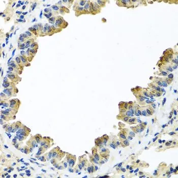 IHC-P analysis of mouse lung tissue using GTX55503 alpha 1 Antichymotrypsin antibody. Dilution : 1:100