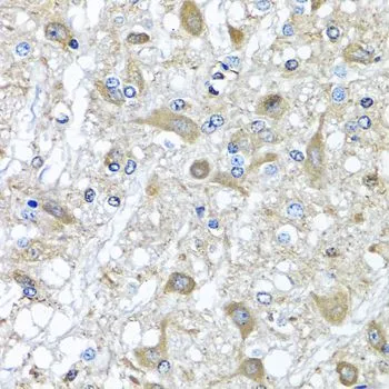 IHC-P analysis of rat brain tissue using GTX55503 alpha 1 Antichymotrypsin antibody. Dilution : 1:100