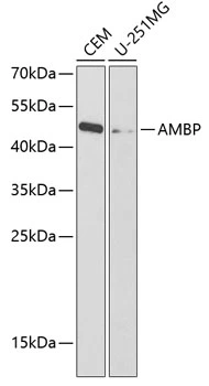 WB analysis of various sample lysates using GTX55504 Alpha 1 Microglobulin antibody. Dilution : 1:1000 Loading : 25microg per lane WB analysis of various sample lysates using GTX55504 Alpha 1 Microglobulin antibody. Dilution : 1:1000 Loading : 25microg per lane