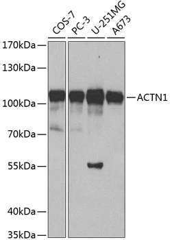 WB analysis of various sample lysates using GTX55505 alpha Actinin 1 antibody. Dilution : 1:500 Loading : 25microg per lane WB analysis of various sample lysates using GTX55505 alpha Actinin 1 antibody. Dilution : 1:500 Loading : 25microg per lane