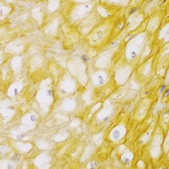 IHC-P analysis of human esophagus tissue using GTX55505 alpha Actinin 1 antibody. Dilution : 1:100