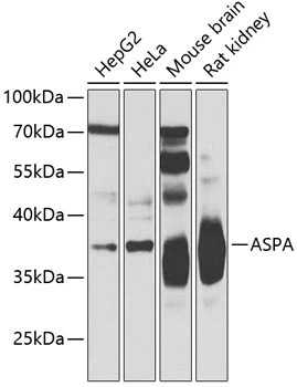 WB analysis of various sample lysates using GTX55521 Aspartoacylase antibody. Dilution : 1:500 Loading : 25microg per lane WB analysis of various sample lysates using GTX55521 Aspartoacylase antibody. Dilution : 1:500 Loading : 25microg per lane