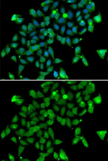 ICC/IF analysis of MCF7 cells using GTX55521 Aspartoacylase antibody. Blue : DAPI