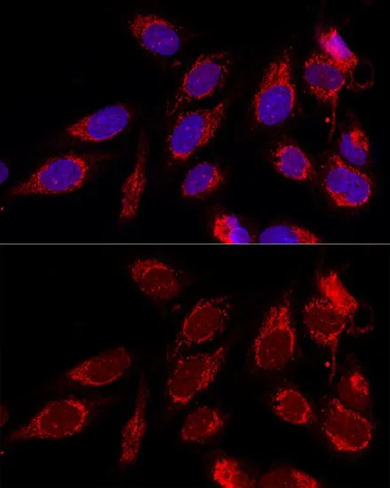 ICC/IF analysis of U2OS cells using GTX55522 ATAD3B antibody. Blue : DAPI Dilution : 1:100