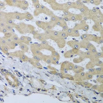 IHC-P analysis of human liver damage tissue using GTX55522 ATAD3B antibody. Dilution : 1:100