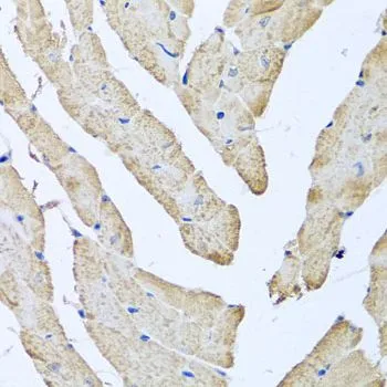 IHC-P analysis of mouse heart tissue using GTX55522 ATAD3B antibody. Dilution : 1:100