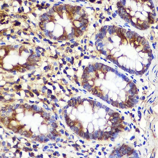 IHC-P analysis of human colon tissue using GTX55523 ATG10 antibody. Dilution : 1:100