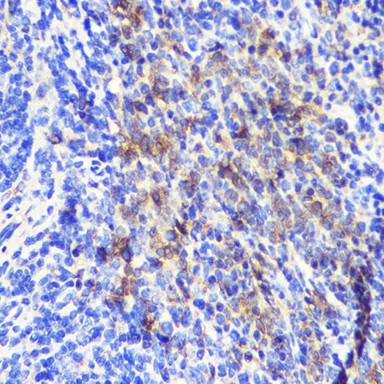 IHC-P analysis of mouse spleen tissue using GTX55523 ATG10 antibody. Dilution : 1:100
