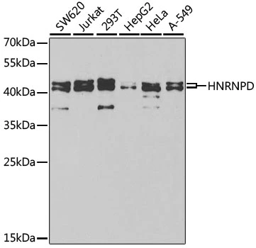 WB analysis of various sample lysates using GTX55526 AUF1 antibody. Dilution : 1:1000 Loading : 25microg per lane WB analysis of various sample lysates using GTX55526 AUF1 antibody. Dilution : 1:1000 Loading : 25microg per lane