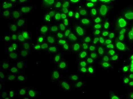 ICC/IF analysis of U2OS cells using GTX55526 AUF1 antibody.