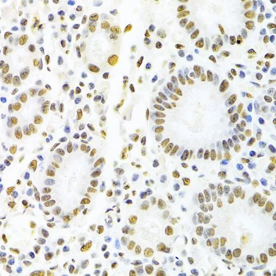 IHC-P analysis of human stomach tissue using GTX55526 AUF1 antibody. Dilution : 1:100