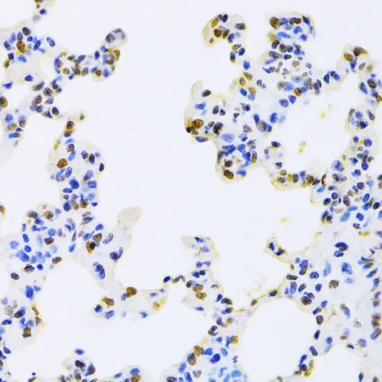 IHC-P analysis of rat lung tissue using GTX55526 AUF1 antibody. Dilution : 1:100