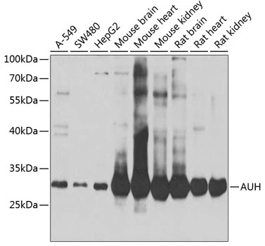 WB analysis of various sample lysates using GTX55527 AUH antibody. Dilution : 1:1000 Loading : 25microg per lane WB analysis of various sample lysates using GTX55527 AUH antibody. Dilution : 1:1000 Loading : 25microg per lane