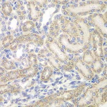 IHC-P analysis of rat kidney tissue using GTX55527 AUH antibody. Dilution : 1:100