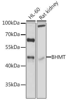 WB analysis of various sample lysates using GTX55537 BHMT antibody. Dilution : 1:1000 Loading : 25microg per lane WB analysis of various sample lysates using GTX55537 BHMT antibody. Dilution : 1:1000 Loading : 25microg per lane