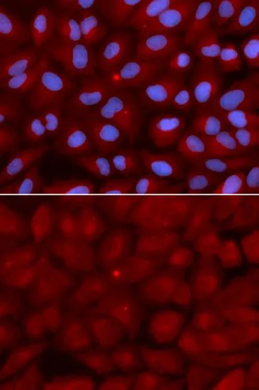 ICC/IF analysis of U2OS cells using GTX55538 BIN1 antibody. Blue : DAPI