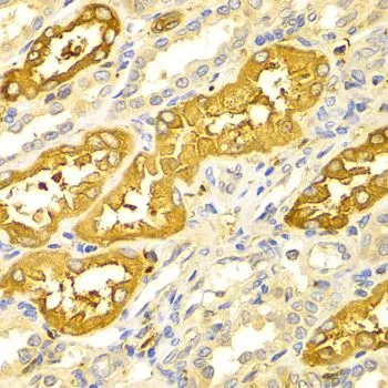 IHC-P analysis of human kidney tissue using GTX55538 BIN1 antibody. Dilution : 1:100