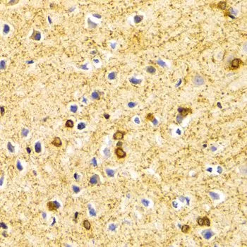 IHC-P analysis of rat brain tissue using GTX55538 BIN1 antibody. Dilution : 1:100
