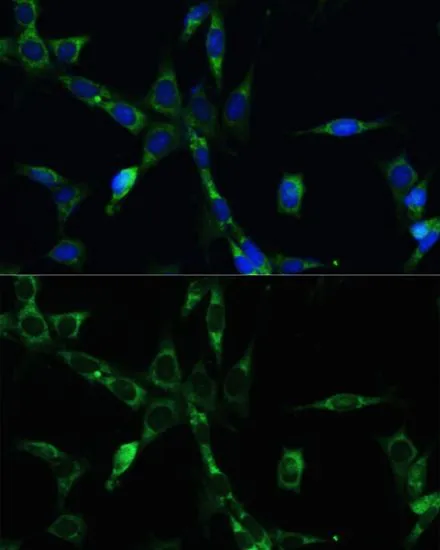 ICC/IF analysis of NIH-3T3 cells using GTX55541 BUB1B antibody. Blue : DAPI Dilution : 1:100