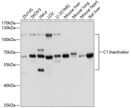 WB analysis of various sample lysates using GTX55542 C1 inhibitor antibody. Dilution : 1:1000 Loading : 25microg per lane WB analysis of various sample lysates using GTX55542 C1 inhibitor antibody. Dilution : 1:1000 Loading : 25microg per lane