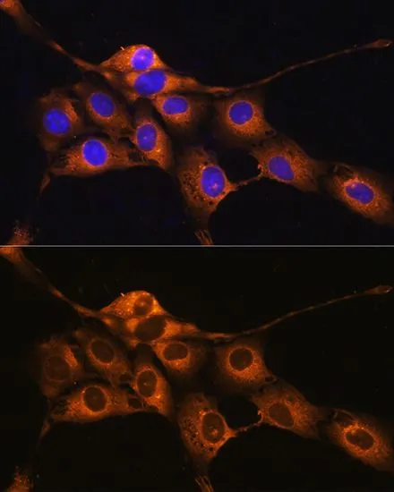 ICC/IF analysis of NIH/3T3 cells using GTX55542 C1 inhibitor antibody. Blue : DAPI Dilution : 1:100