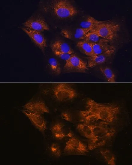 ICC/IF analysis of C6 cells using GTX55542 C1 inhibitor antibody. Blue : DAPI Dilution : 1:100