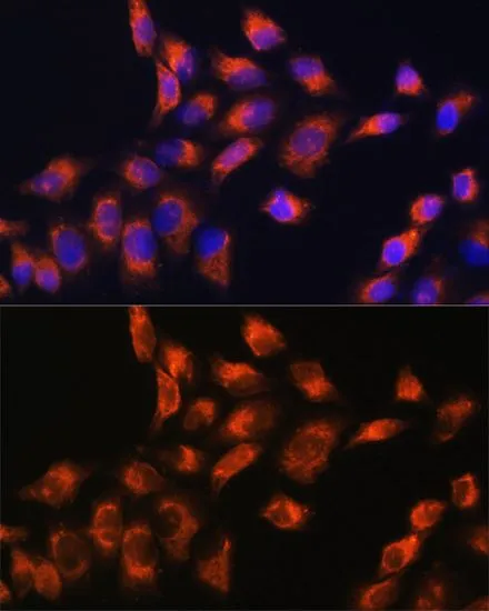 ICC/IF analysis of HeLa cells using GTX55542 C1 inhibitor antibody. Blue : DAPI Dilution : 1:100