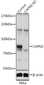 WB analysis of various sample lysates using GTX55545 Calpain 2 antibody. Dilution : 1:1000 Loading : 25microg per lane