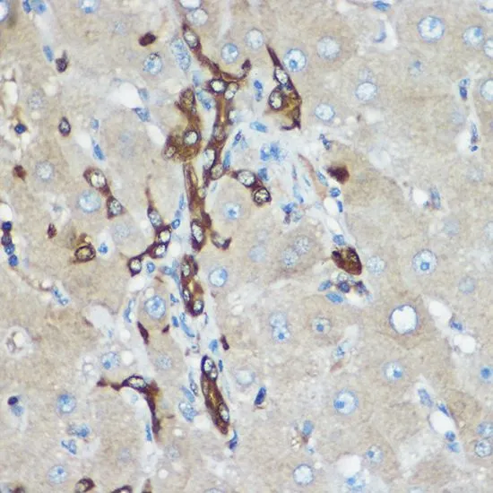 ICC/IF analysis of U2OS cells using GTX55545 Calpain 2 antibody. Blue : DAPI Dilution : 1:100