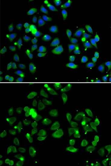 ICC/IF analysis of A549 cells using GTX55548 CARD11 antibody. Blue : DAPI