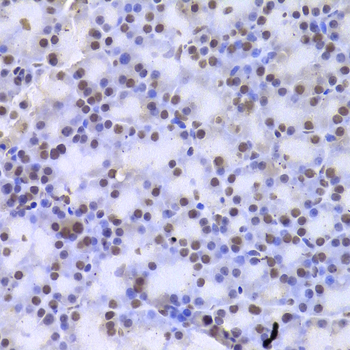 IHC-P analysis of rat pancreas tissue using GTX55549 Casein Kinase 1 epsilon antibody. Dilution : 1:100
