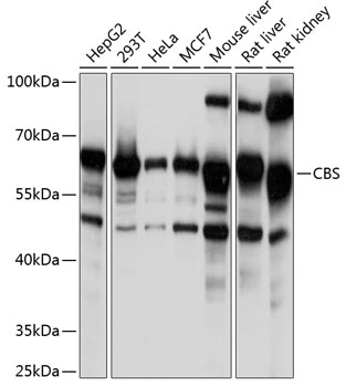 WB analysis of various sample lysates using GTX55551 CBS antibody. Dilution : 1:1000 Loading : 25microg per lane WB analysis of various sample lysates using GTX55551 CBS antibody. Dilution : 1:1000 Loading : 25microg per lane