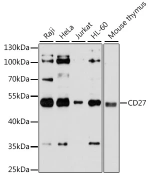 WB analysis of various sample lysates using GTX55555 CD27 antibody. Dilution : 1:3000 Loading : 25microg per lane WB analysis of various sample lysates using GTX55555 CD27 antibody. Dilution : 1:3000 Loading : 25microg per lane