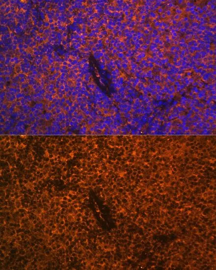 IHC-P analysis of rat thymus tissue using GTX55555 CD27 antibody. Blue : DAPI Dilution : 1:100