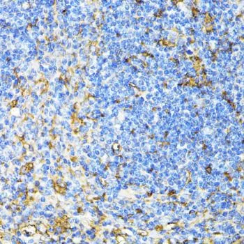 IHC-P analysis of mouse spleen tissue using GTX55555 CD27 antibody. Dilution : 1:100