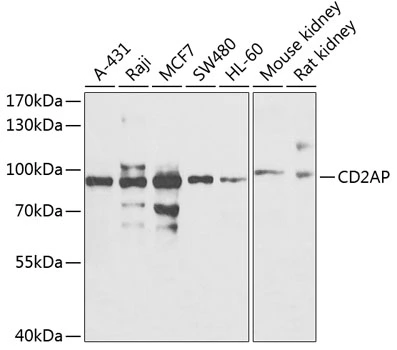 WB analysis of various sample lysates using GTX55556 CD2AP antibody. The signal was developed with ECL plus-Enhanced. Dilution : 1:500 Loading : 25microg per lane WB analysis of various sample lysates using GTX55556 CD2AP antibody. The signal was developed with ECL plus-Enhanced. Dilution : 1:500 Loading : 25microg per lane
