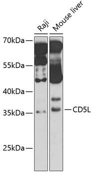 WB analysis of various sample lysates using GTX55561 CD5L antibody. Dilution : 1:1000 Loading : 25microg per lane WB analysis of various sample lysates using GTX55561 CD5L antibody. Dilution : 1:1000 Loading : 25microg per lane