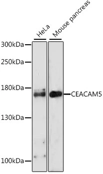 WB analysis of various sample lysates using GTX55562 CD66e antibody. The signal was developed with ECL plus-Enhanced. Dilution : 1:1000 Loading : 25microg per lane