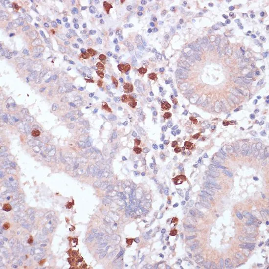IHC-P analysis of human colon tissue using GTX55563 CD82 antibody. Dilution : 1:100