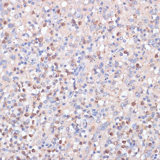 IHC-P analysis of human spleen tissue using GTX55563 CD82 antibody. Dilution : 1:100